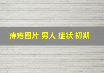 痔疮图片 男人 症状 初期